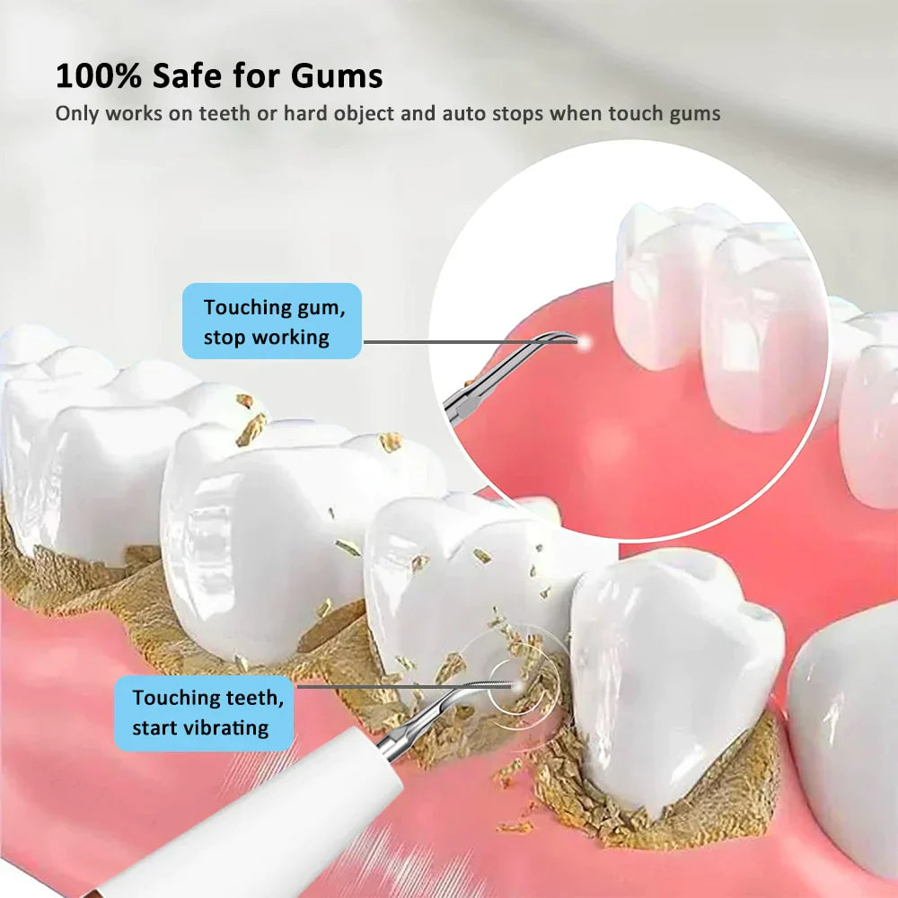 Unisex Ultrasonic Tooth Cleaner Effective Gentle Plaque Removal Plastic Metal-2